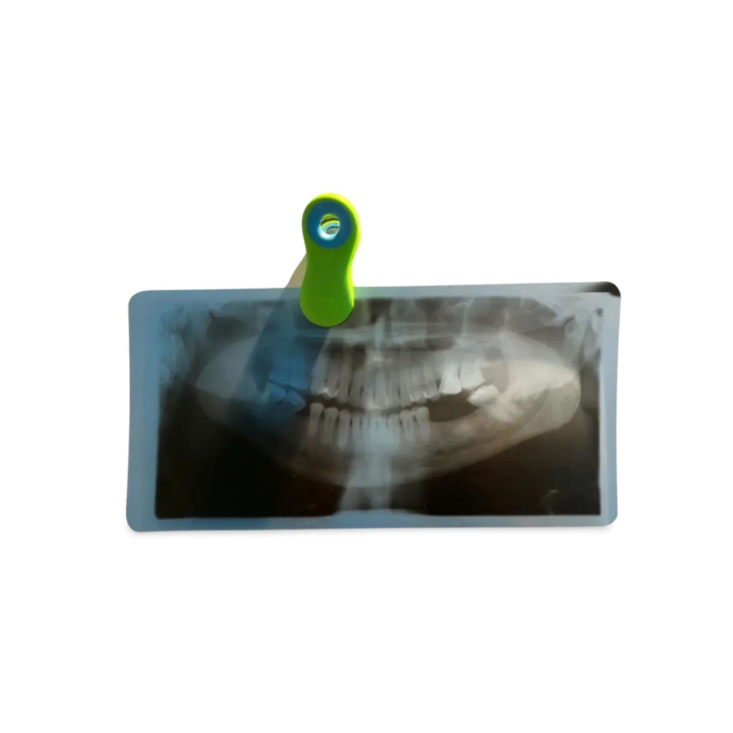 X-ray - Hospital / Dental
