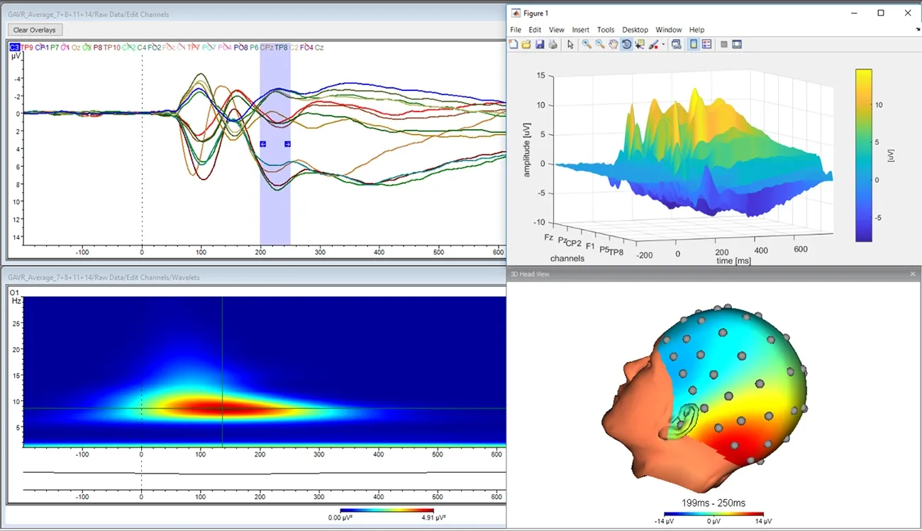 Brain Vision Analyser