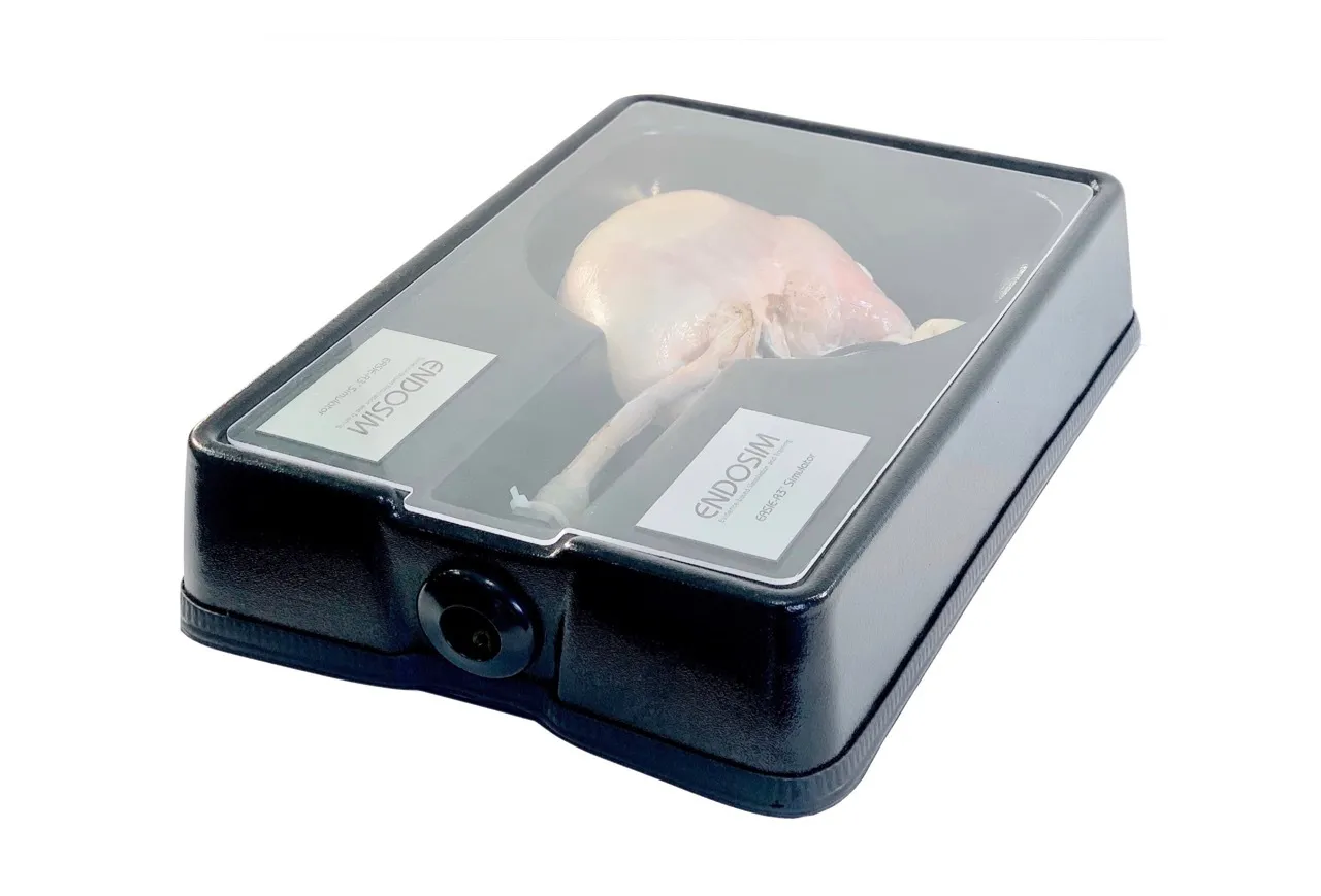 Stomach Specimen with Lesion in Esophagus