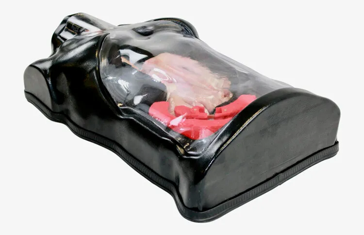 Foreign Body Removal Specimen