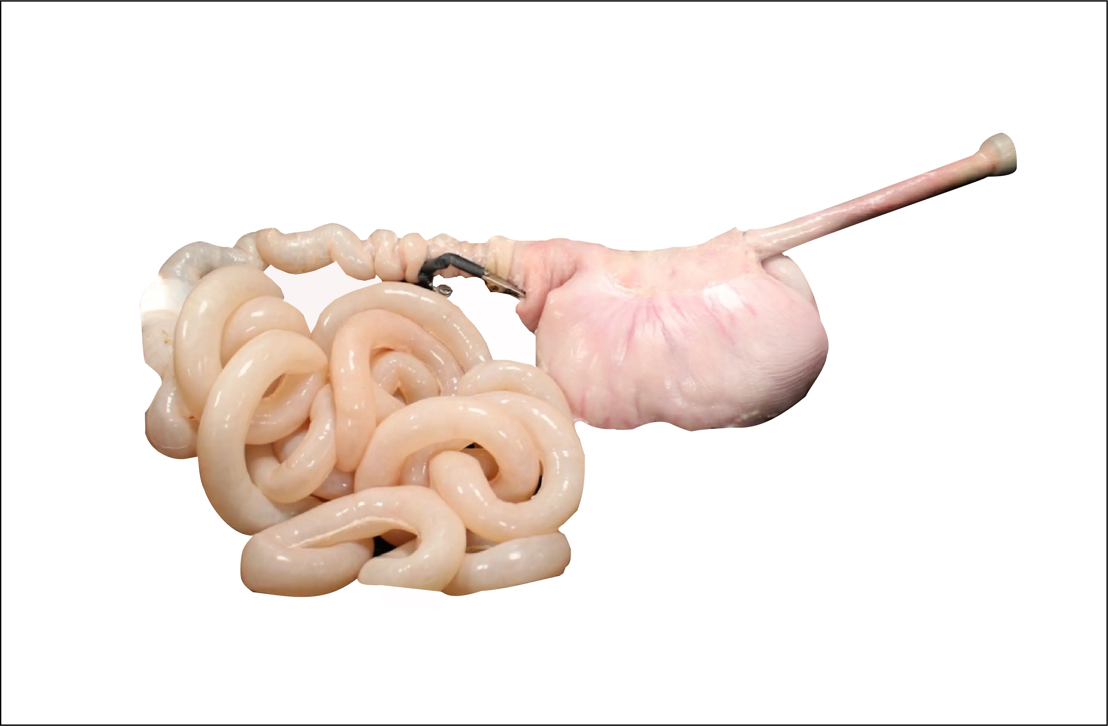 Balloon Enteroscopy Specimen