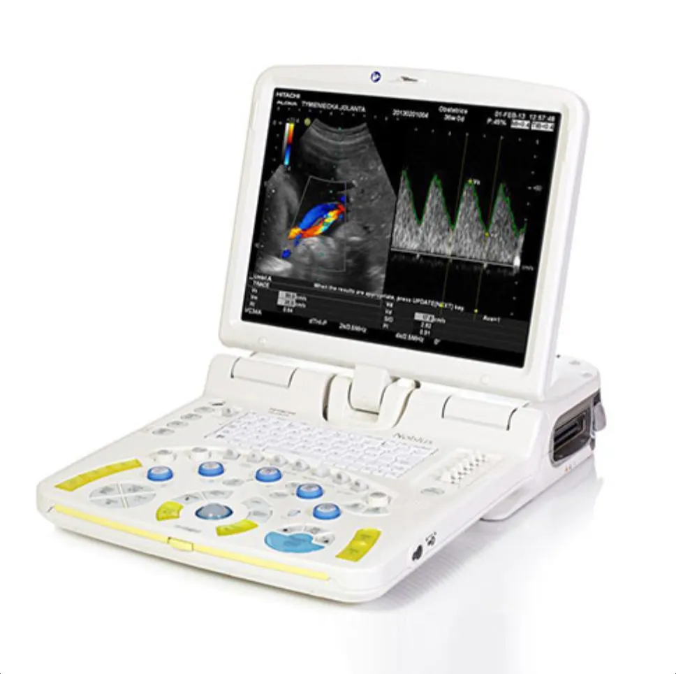 Noblus Utrasound Processor