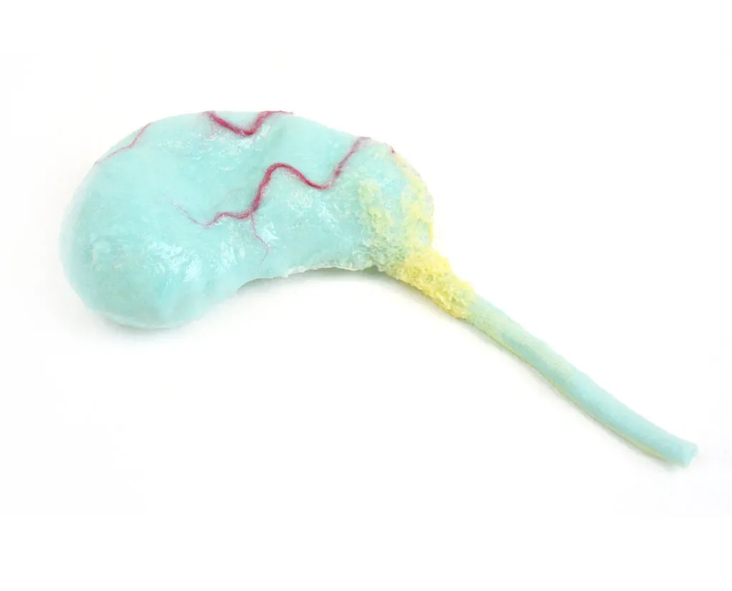 Synthetic Gallbladder 