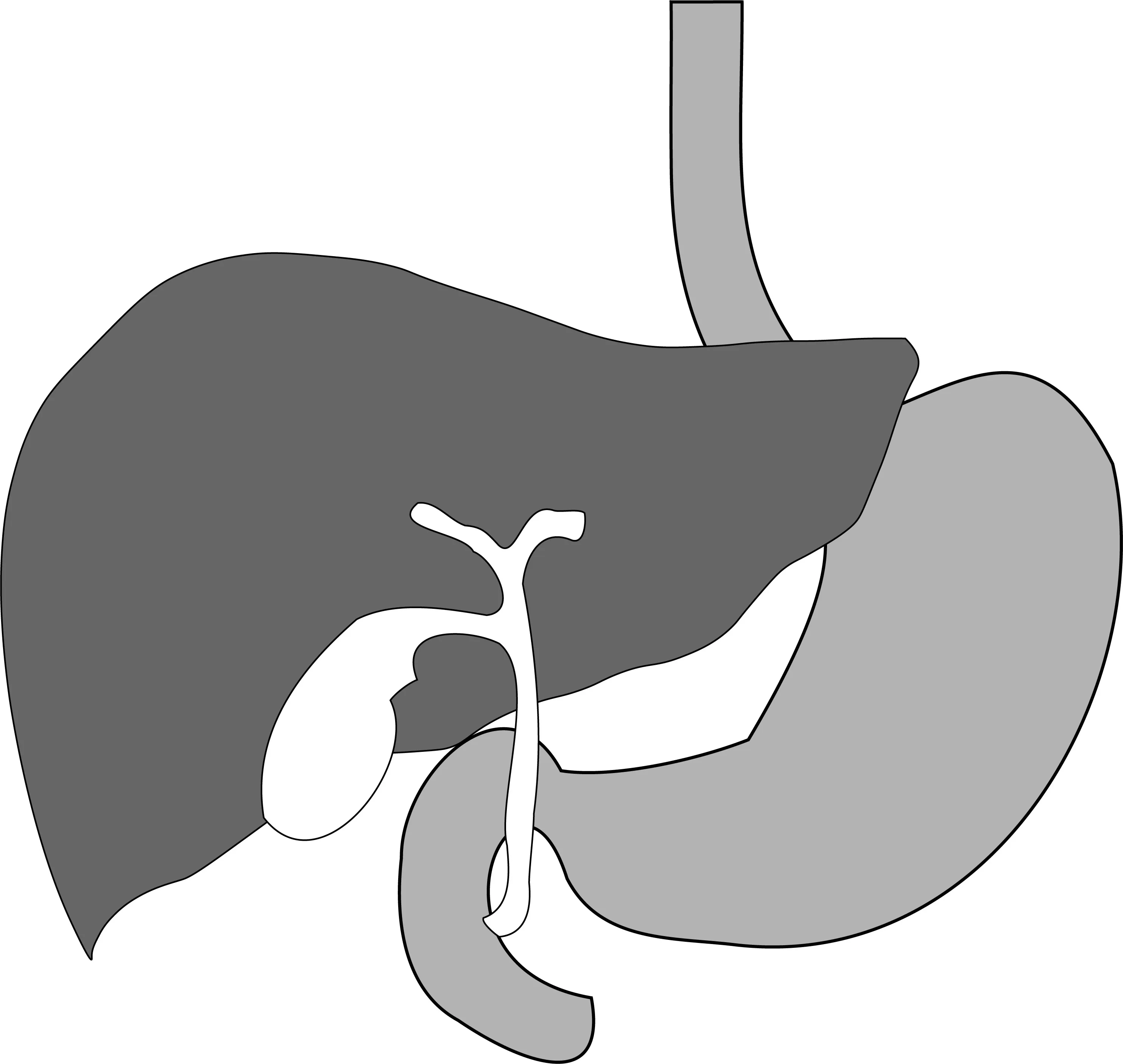 ERCP Specimen-Porcine_Biliary-Tract-Liver-Gallbladder