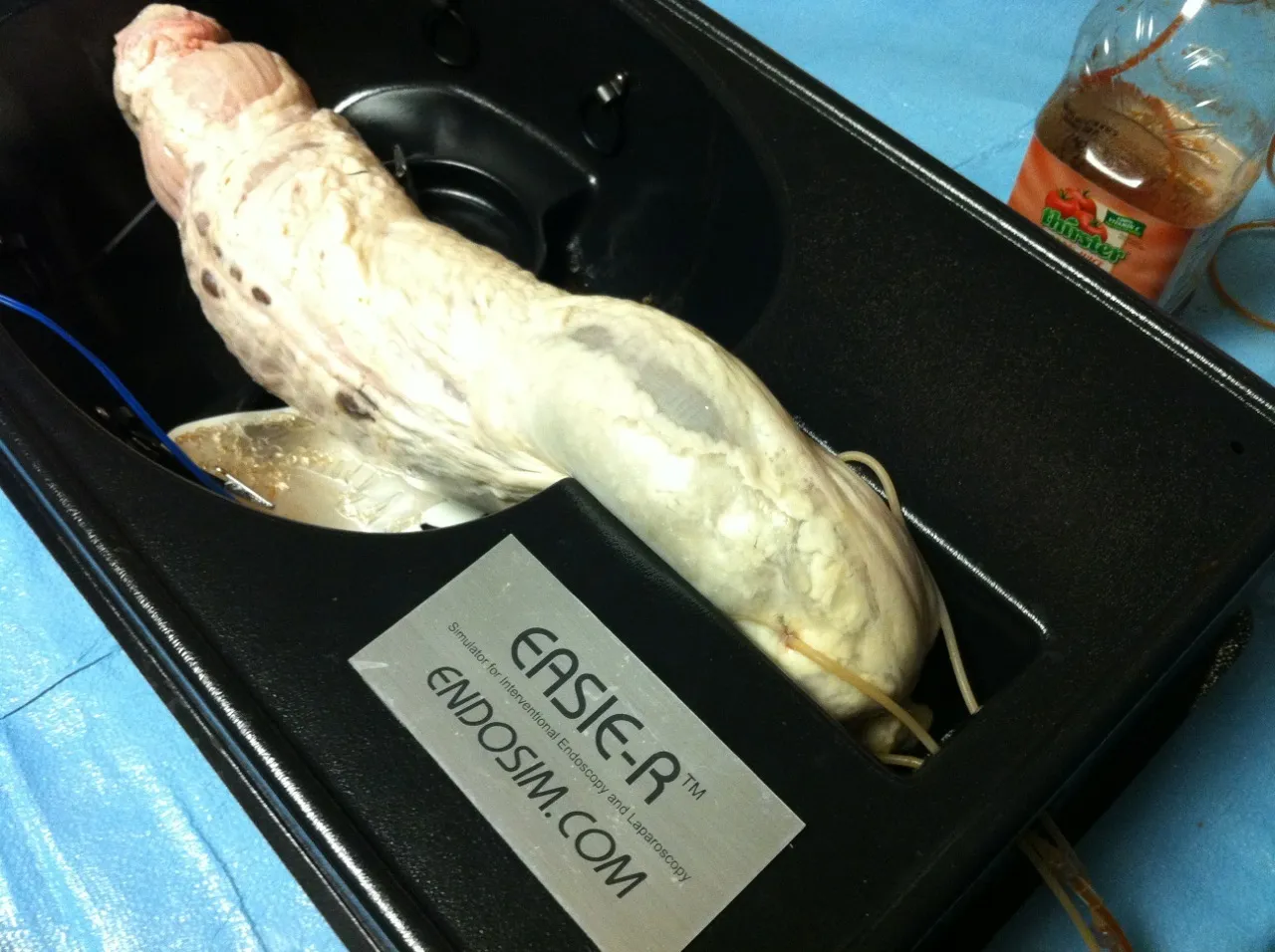 Lower Gastrointestinal Bleeding Specimen