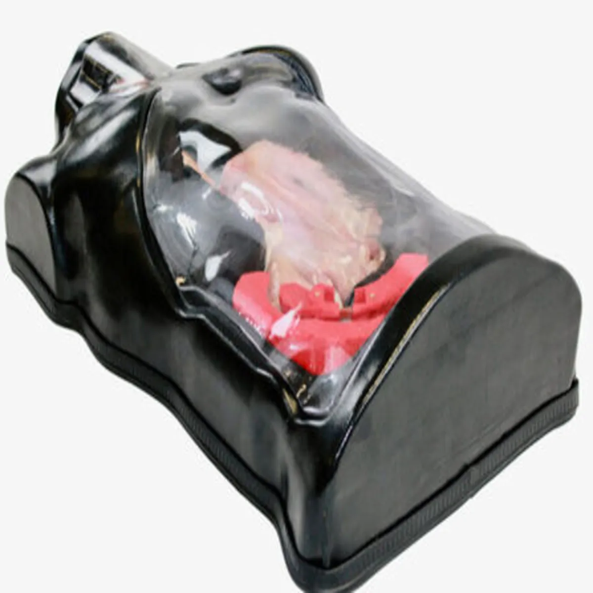 Gastric Defect Specimen