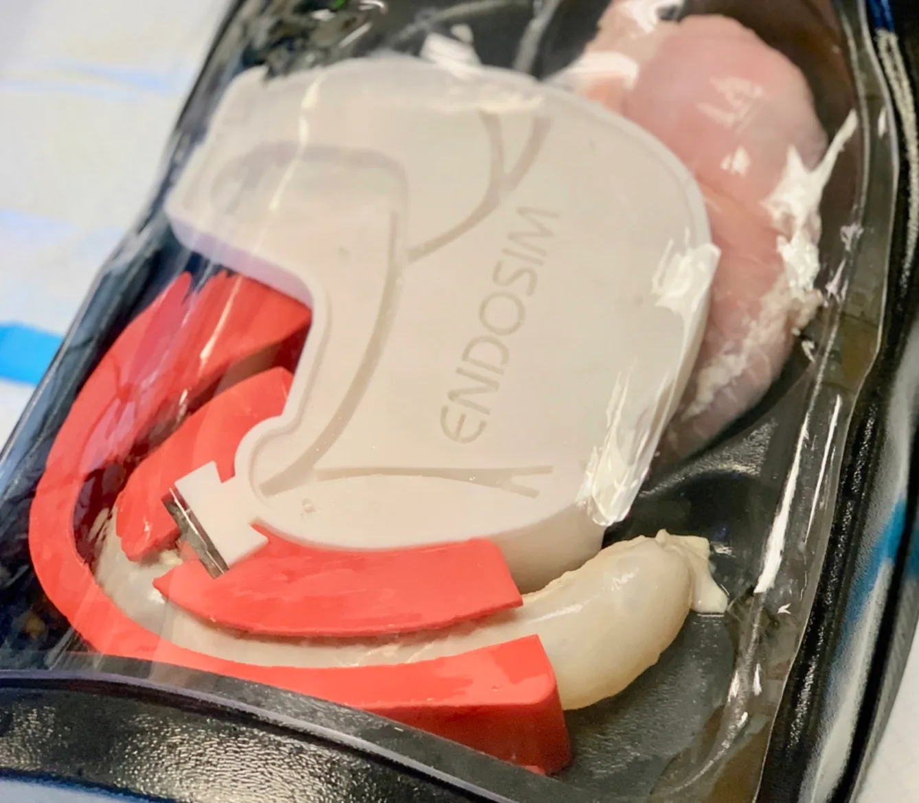 ERCP NeoPapilla Specimen