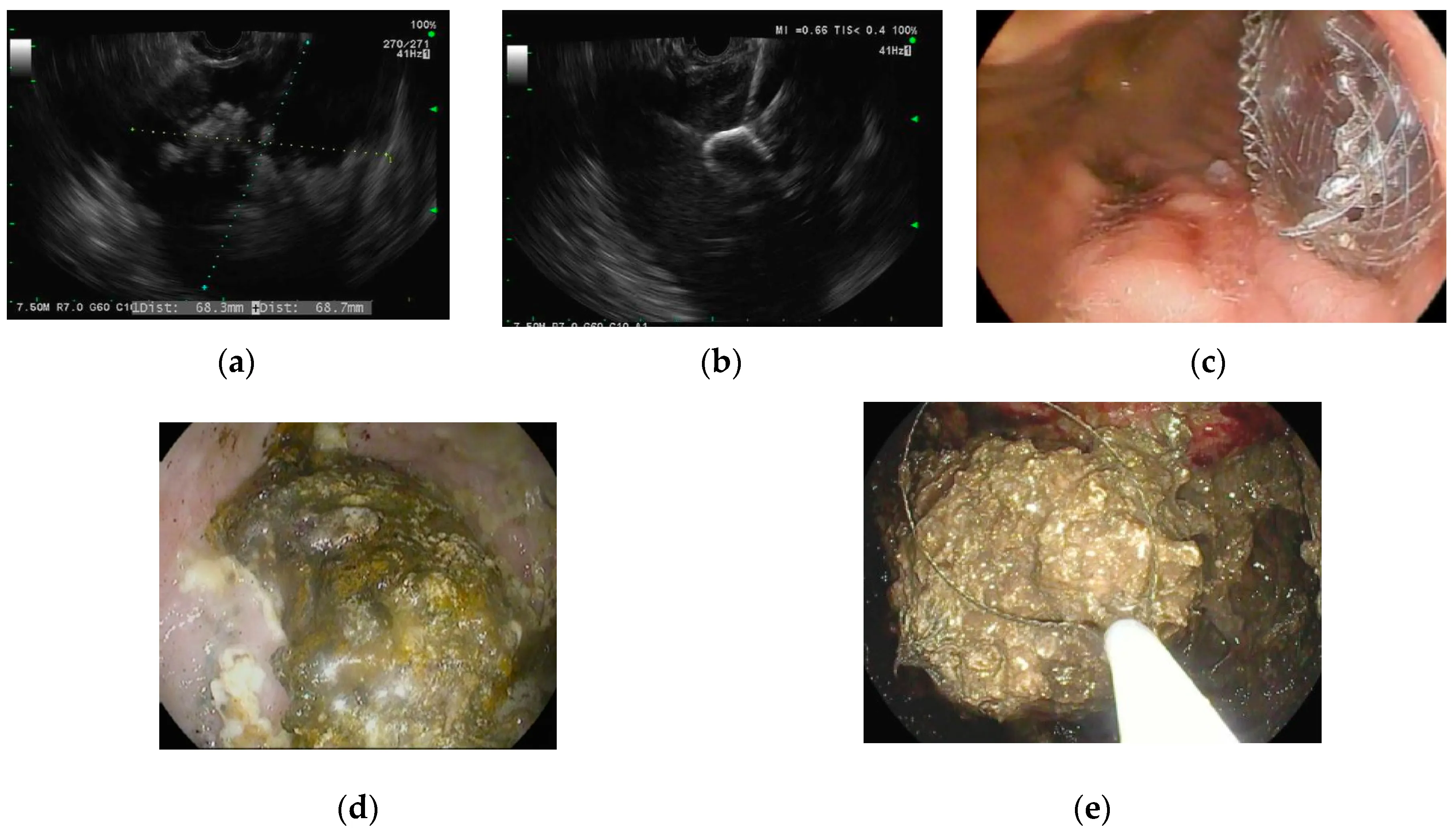Axios Specimen w/cysts - Liver Stomach Specimen