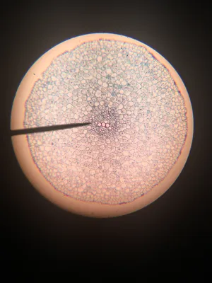 Slides: Typical Dicot Root, c.s.