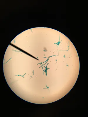 Slides: Moss Protonema w.m.
