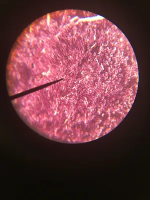 Slides: Spinal Nerve silver stain