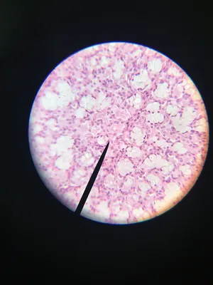 Slides: Human Salivary Gland, Sublingual