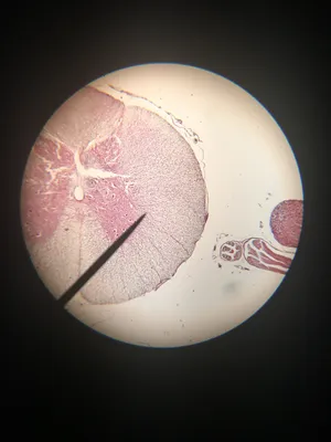 Slides: Spinal cord dorsal root ganglion, c.s.