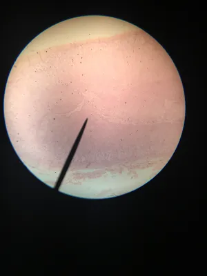 Slides-Adrenal gland 