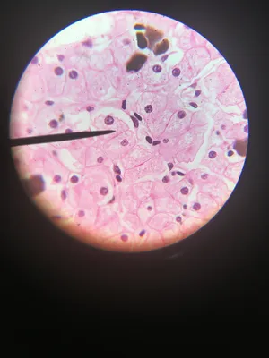 Slides-Amphiuma liver section