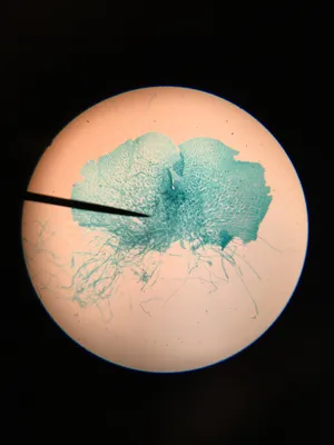 Slides: Fern Archegonia, w.m.