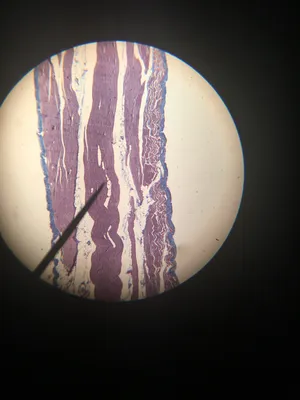 Slides-Muscle types (smooth, striated, & cardiac) sec.