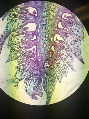 Slides: Pine, Young Ovulate Cone l.s.