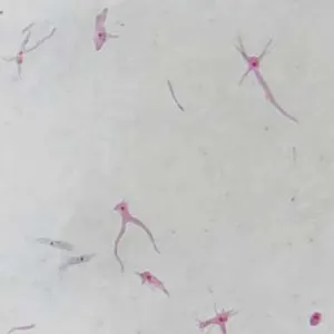 Slides-Amoeba proteus w.m.