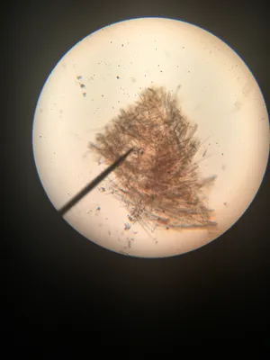Slides: Freshwater Sponge