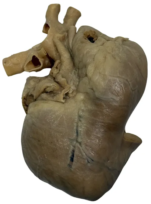 Real Plastinated Heart