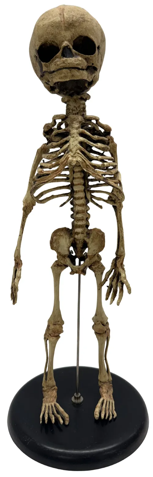 Human Fetal Skeleton Model On Black Stand