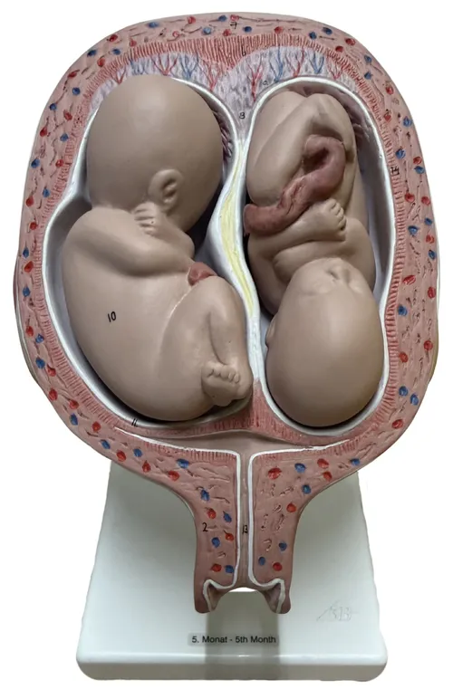 Five Month Twin Fetal Pregnancy Model On White Base