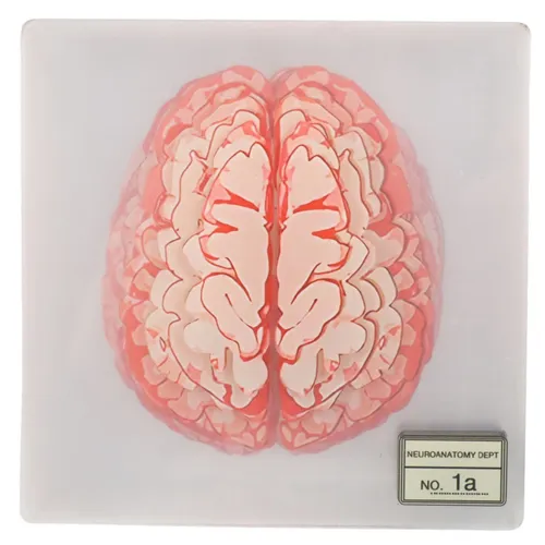 Human Brain Slices Plastic Coaster