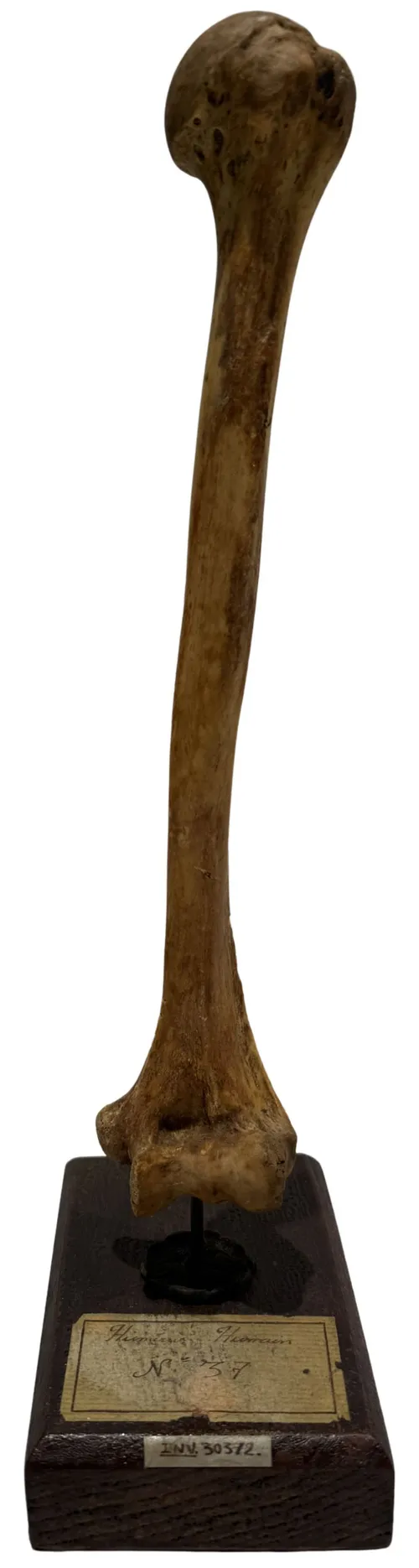 Natural Human Humerus Bone On Stand