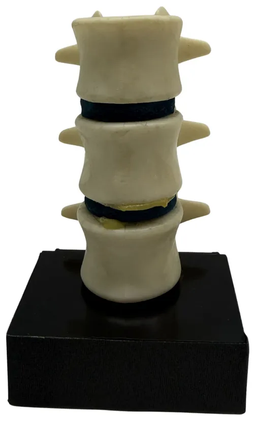 Human Vertebrae Spine Model On Black Base