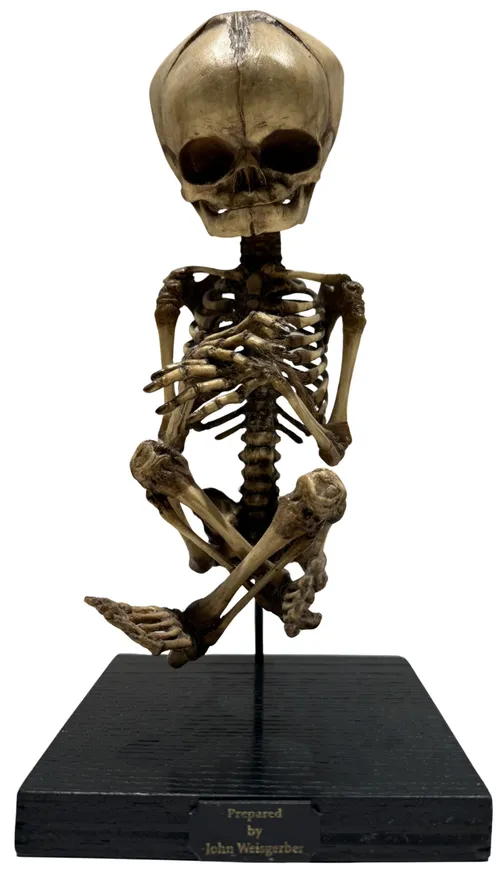 Cast Replica Human Fetal Skeleton On Black Wood Base