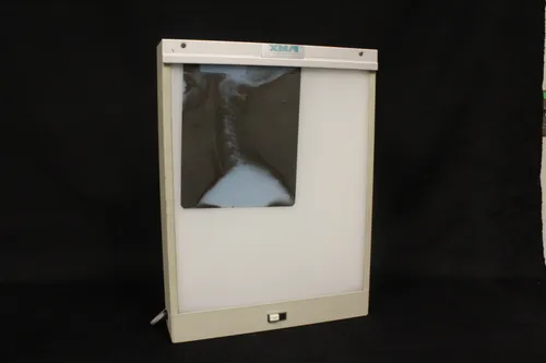 X-ray Screen