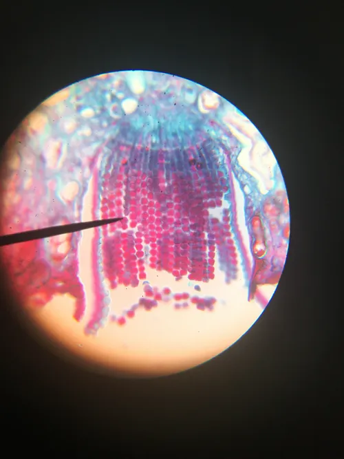 Slides: Puccinia graminis (wheat rust) Aecia