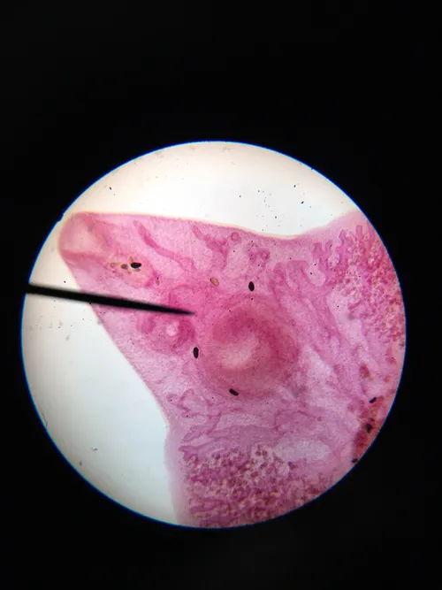 Slides-Fasciola hepatica (liver fluke), w.m.