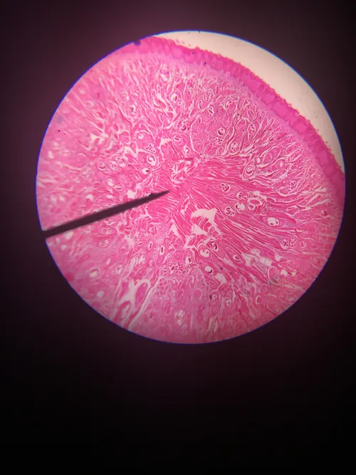 Slides: Trichinella spiralis Encysted Larvae sec.
