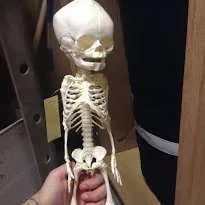 Anatomy-Fetal Skeleton