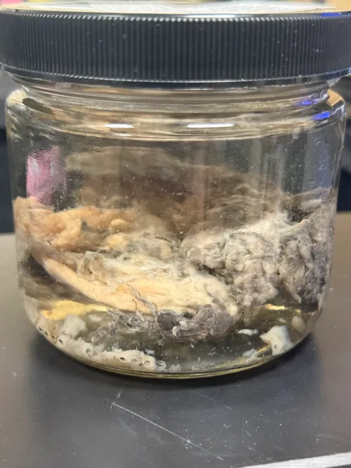 Pregnancy Embryo Regression 11 weeks 