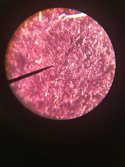 Slides: Spinal Nerve silver stain