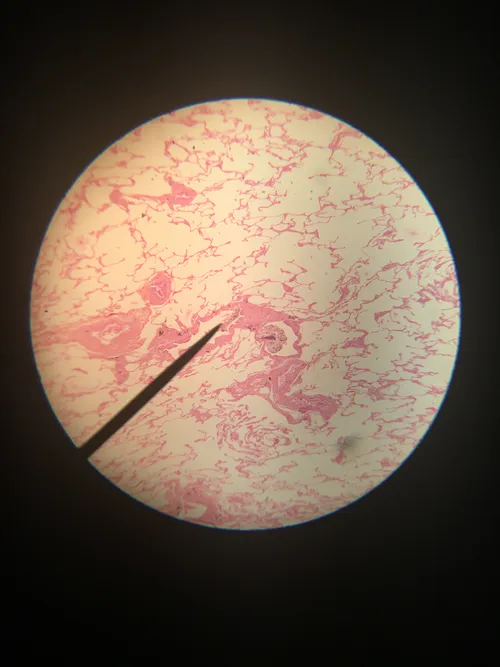 Slides: Human lung tissue sec.
