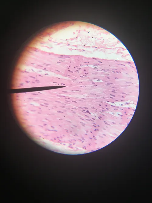 Slides: Human Transitional Epithelium
