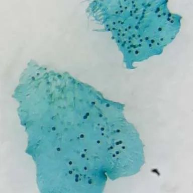 Slides-Fern Antherida & Archegonia w.m.