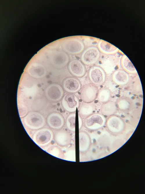 Slides: Meiotic Divisions, Ascaris equorum (roundworm) sec.