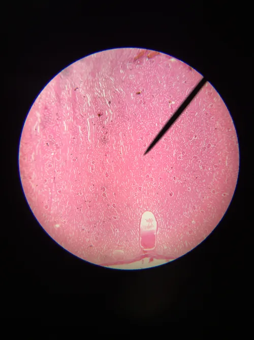 Slides: Kidney near-median, l.s.
