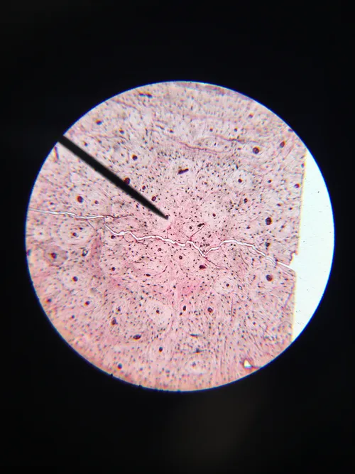 Slides: Mammal compact bone ground, c.s.