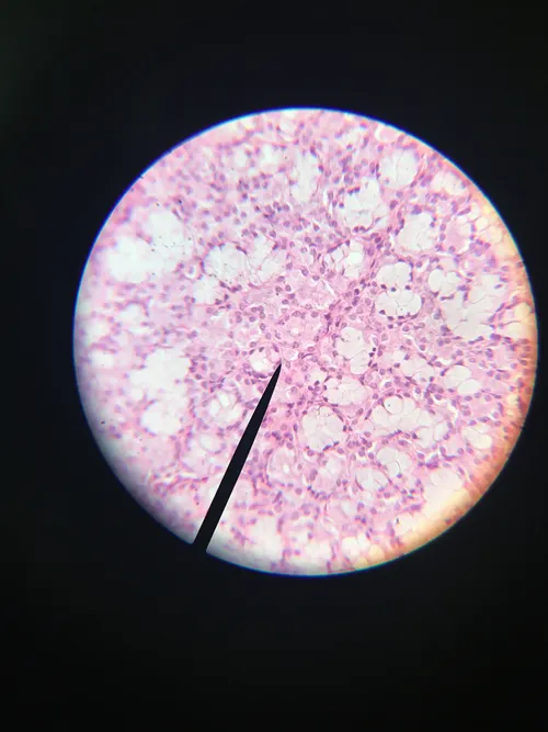 Slides: Human Salivary Gland, Sublingual