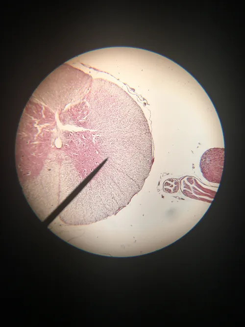 Slides: Spinal cord dorsal root ganglion, c.s.