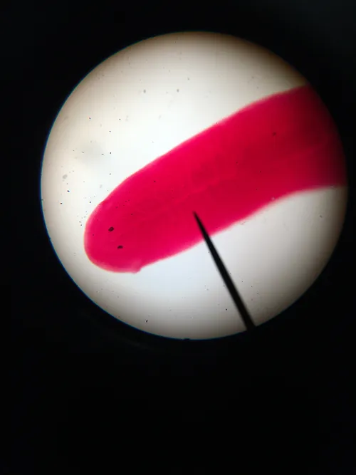 Slides: Planaria (flatwom), w.m.