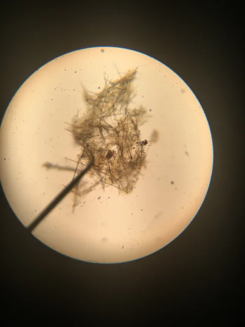 Slides: Marine Sponge