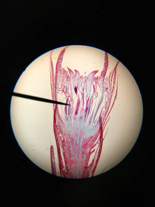 Slides: Moss Antheridial Head, Polytrichium l.s.