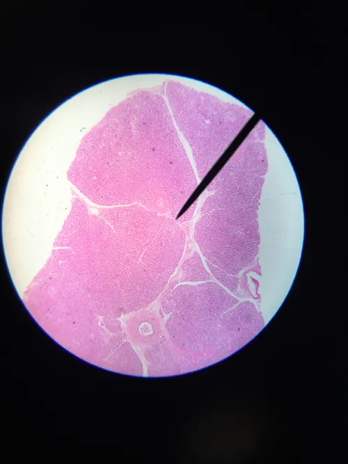 Slides: Human Pancreas sec.